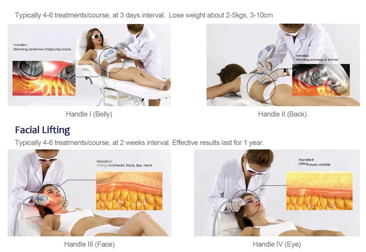 velashape slimming machine