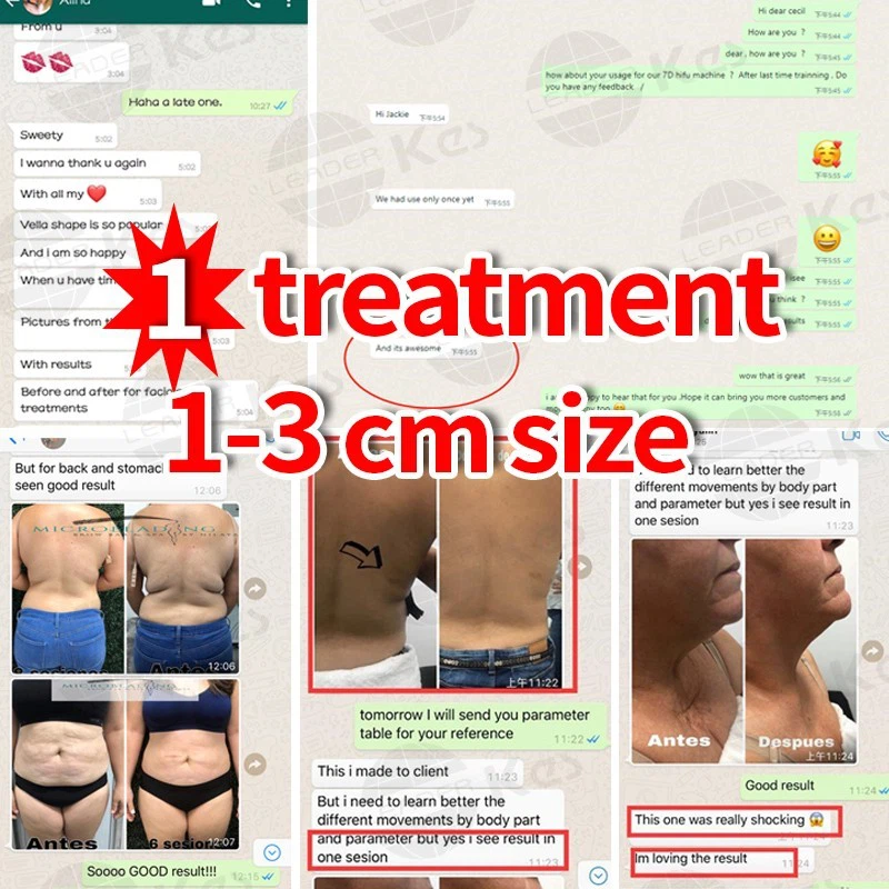 velashape3