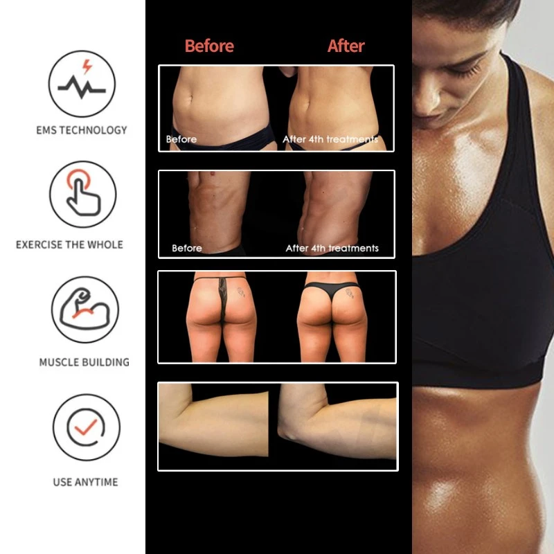 EMSculpt portable11
