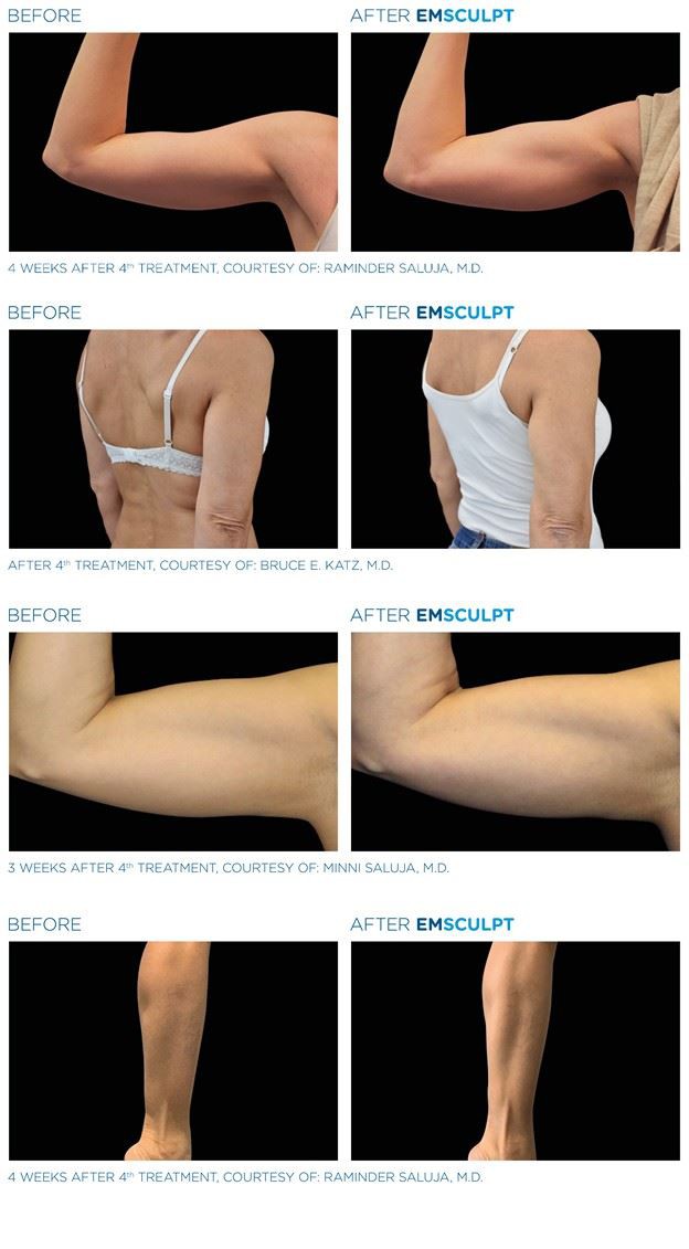 CE Approved Vertical EMS Machine For Muscle Building And Fat Reducing