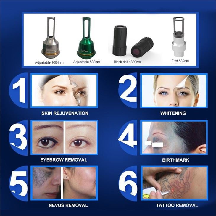 Nd Yag Laser Machine Tattoo Removal