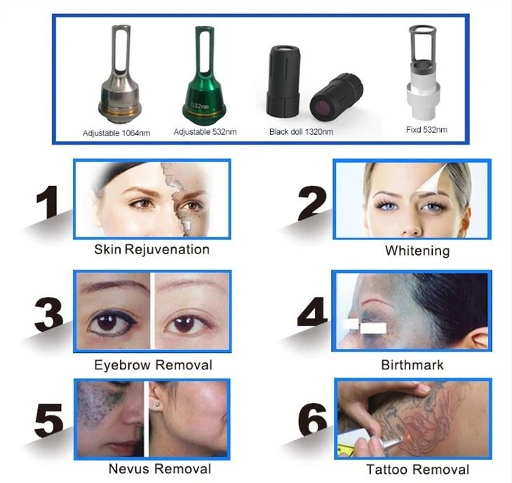 Q Switched Laser Tattoo Removal Machine