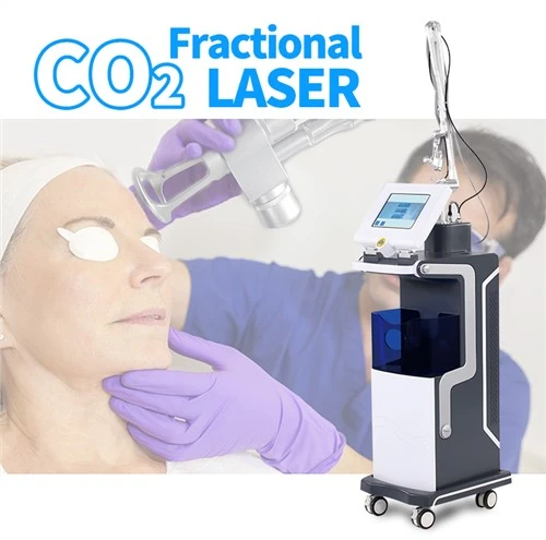 Powerful Fractional Co2 Laser Stretch Marks Removal